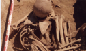 Phát hiện bộ xương ung thư 4.500 năm tuổi