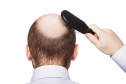 Rụng tóc: Nguyên nhân và cách khắc phục