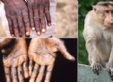 Những điều cần biết về bệnh đậu mùa khỉ
